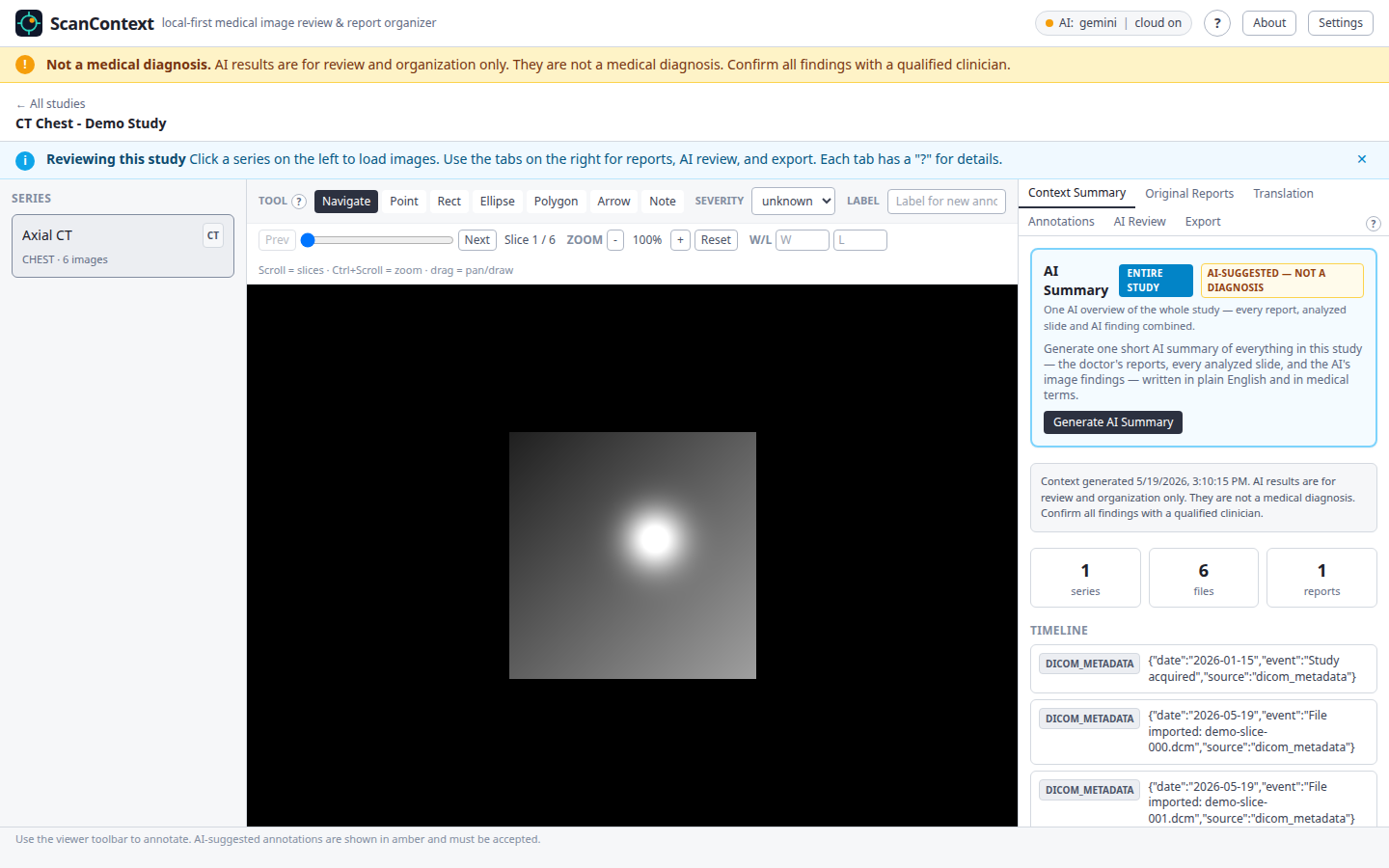 The ScanContext image viewer showing a CT slice.