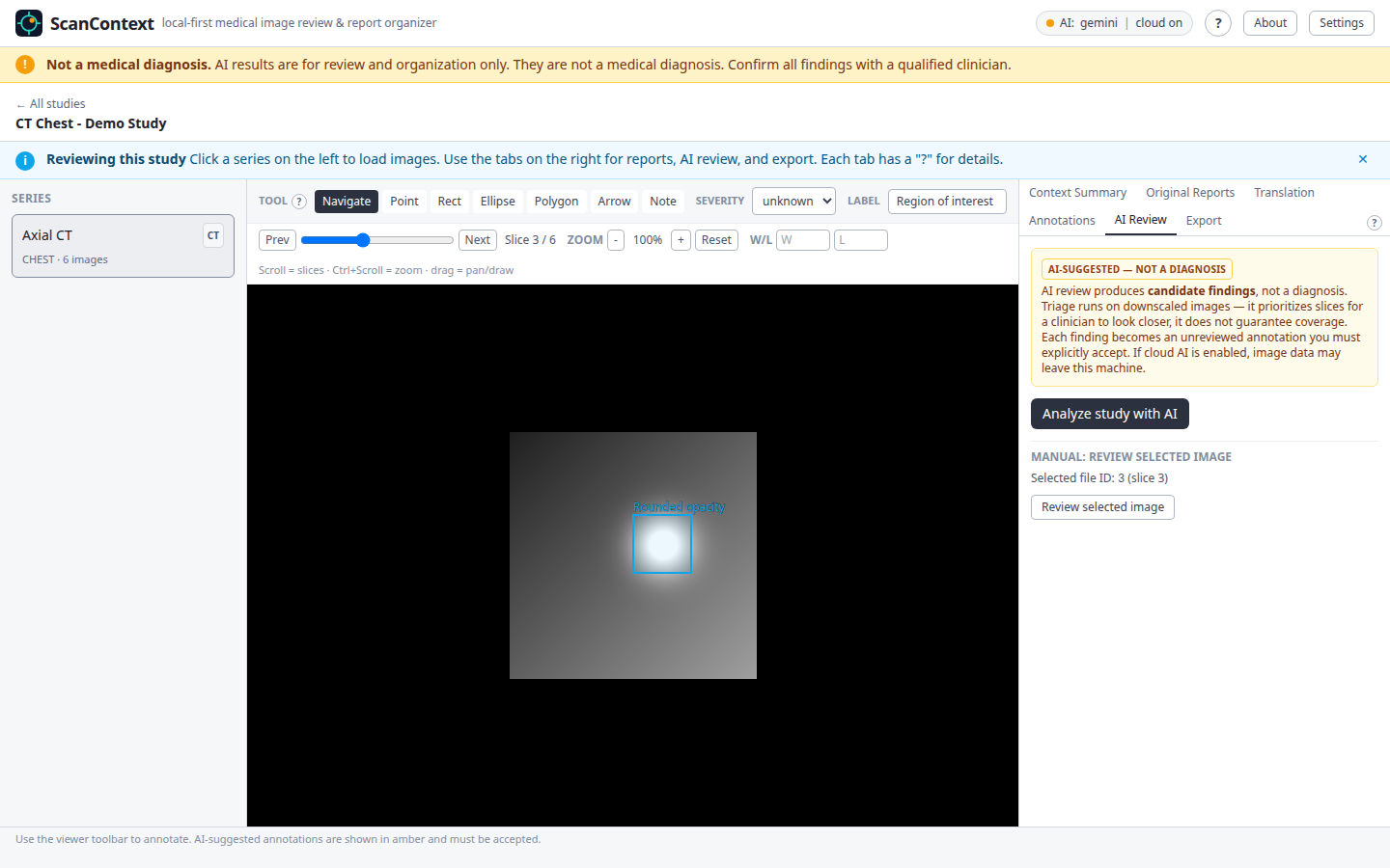 The AI review tab with the Analyze study action.