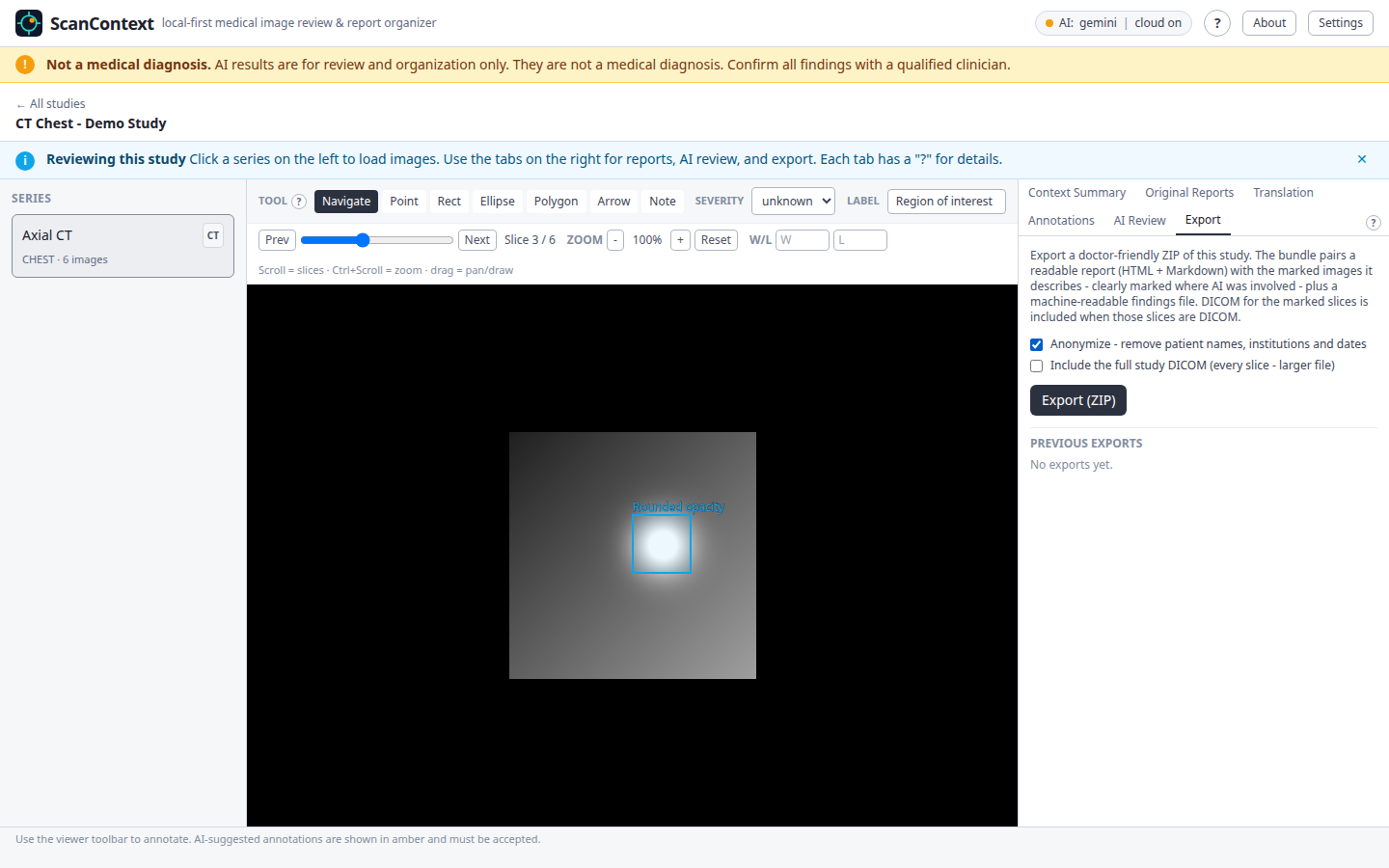 The export tab with the Anonymize option enabled.